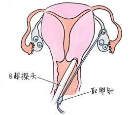 阿法林润康价格说明 厂家不同一盒费用也不同